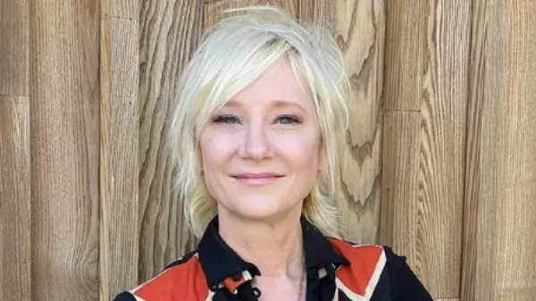 Atriz Anne Heche está coma e em estado crítico