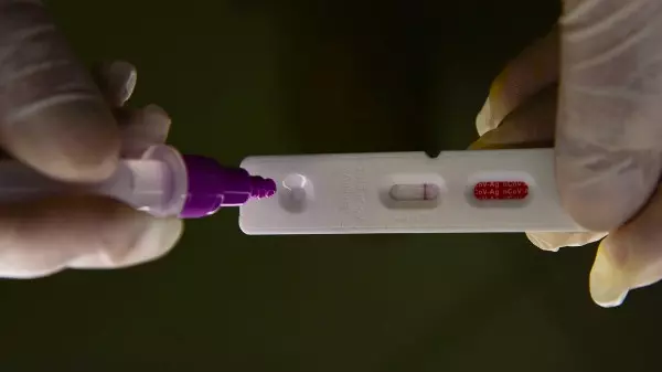 Estudo aponta que reinfecção por covid pode aumentar risco de agravamento e sequelas; entenda